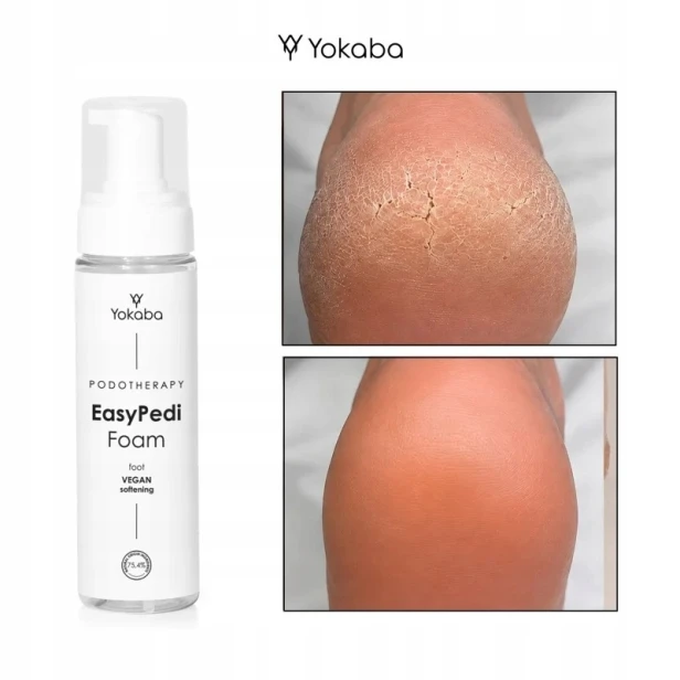 Yokaba Zmiękczająca pianka do pedicure EasyPedi Foam Foot Podotherapy 200ml